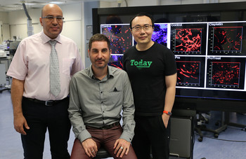 HKU develops novel probiotic mixture “Prohep” that may offer potential therapeutic effects on liver cancer