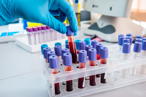 An antibody for predicting Tamoxifen response in breast cancer patients